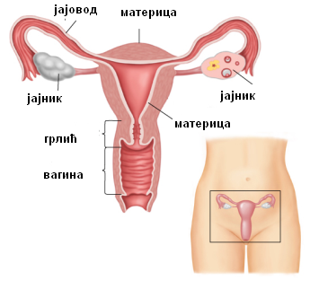 Ženska neplodnost 1 Ženska neplodnost